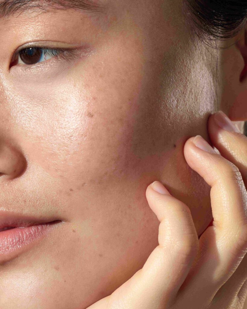 Pigmentation Correction