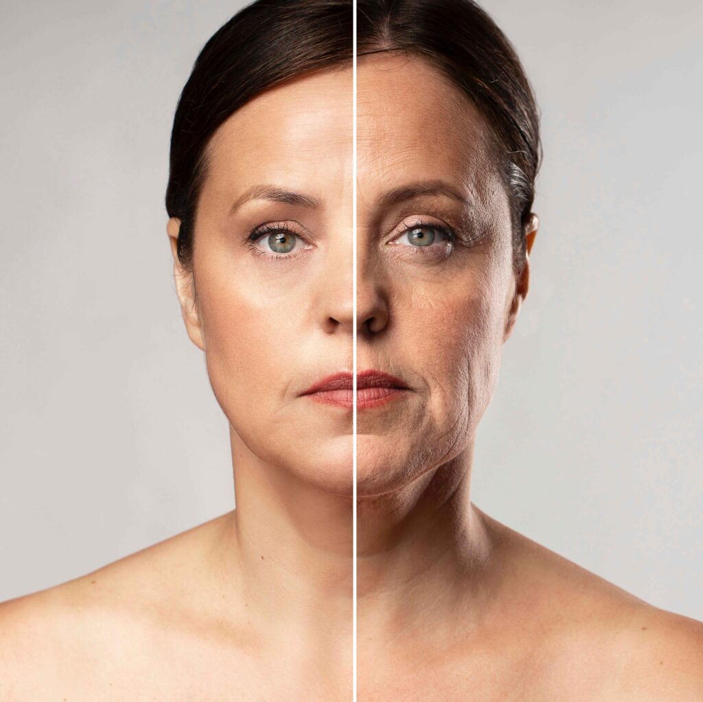 Uneven Skin Tone and Texture